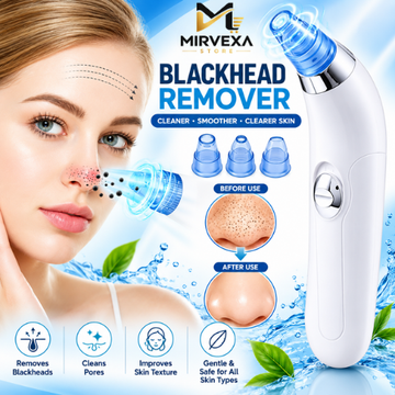 Derma Suction Blackheads Remover Device